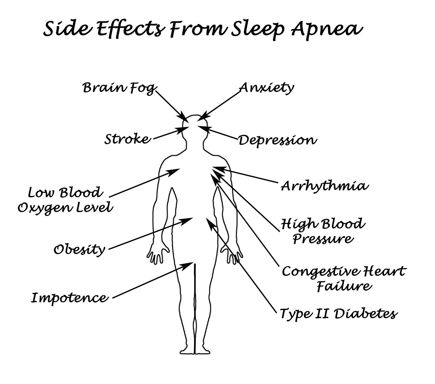 31164387 - sife effects from sleep apnea